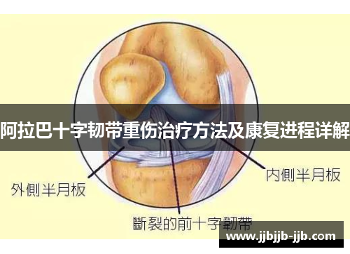 阿拉巴十字韧带重伤治疗方法及康复进程详解